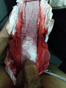 Menstruation vol. 79 07ooq43ifa