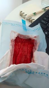 Menstruation vol. 79 47ooq4jxnn