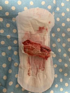Menstruation vol. 79 a7ooq4ohay