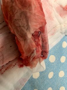Menstruation vol. 79 27ooq4p2bm
