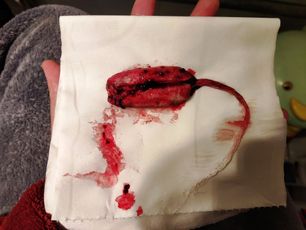 Menstruation vol. 79 q7ooq5mmm5