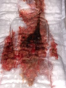 Menstruation vol. 79 e7ooq8bki3