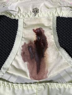 Menstruation vol. 79 i7ooq8uwii
