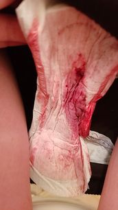 Menstruation vol. 79 57ooq9hszz