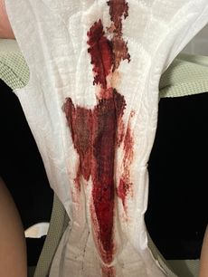 Menstruation vol. 79 q7ooq9ljcb