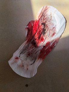 Menstruation vol. 79 27ooq9sic3