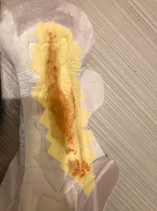 Menstruation vol. 79 67ooqmipxw