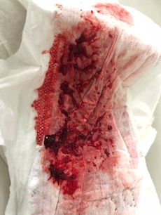 Menstruation vol. 79 37ooqmj1ot