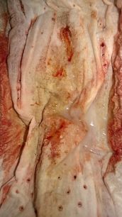 Menstruation vol. 79 x7ooqok2xb