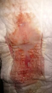 Menstruation vol. 79 j7ooqol243