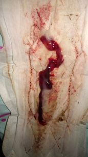 Menstruation vol. 79 u7ooqoos4t