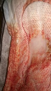 Menstruation vol. 79 s7ooqp8qog