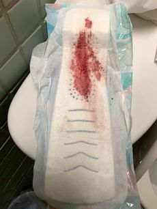 Menstruation vol. 80 v7ooqvkxut