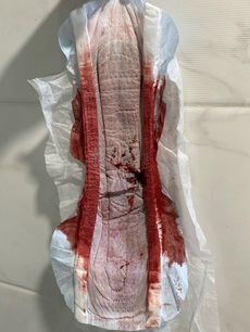 Menstruation vol. 80 27ooqvr2dg