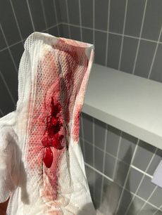 Menstruation vol. 80 f7ooqwlv6i