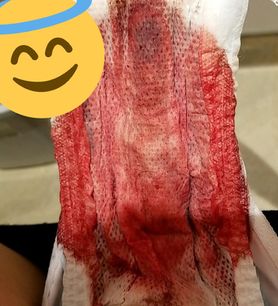 Menstruation vol. 80 37ooqwmx7k