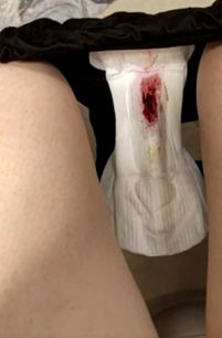 Menstruation vol. 80 17ooqwvcmy