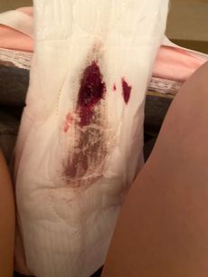 Menstruation vol. 80 j7ooqxat6e