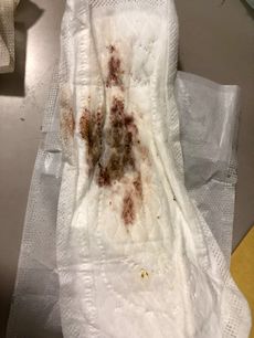 Menstruation vol. 80 e7ooqx8anx