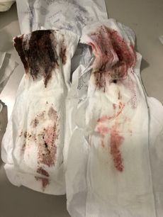 Menstruation vol. 80 w7ooqxr76s