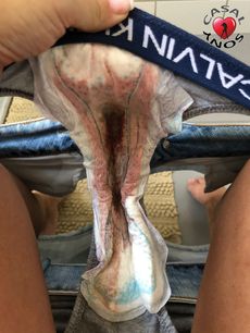 Menstruation vol. 80 x7oorb773u