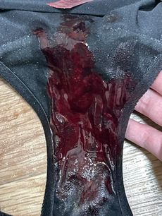 Menstruation vol. 80 h7oorcbnju