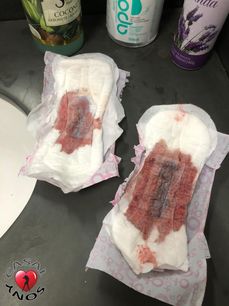 Menstruation vol. 80 x7oorc5ky7