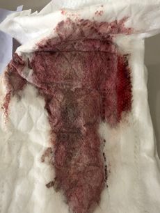 Menstruation vol. 80 n7oorfa1qa